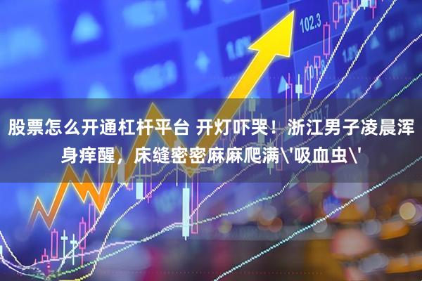 股票怎么开通杠杆平台 开灯吓哭！浙江男子凌晨浑身痒醒，床缝密密麻麻爬满'吸血虫'